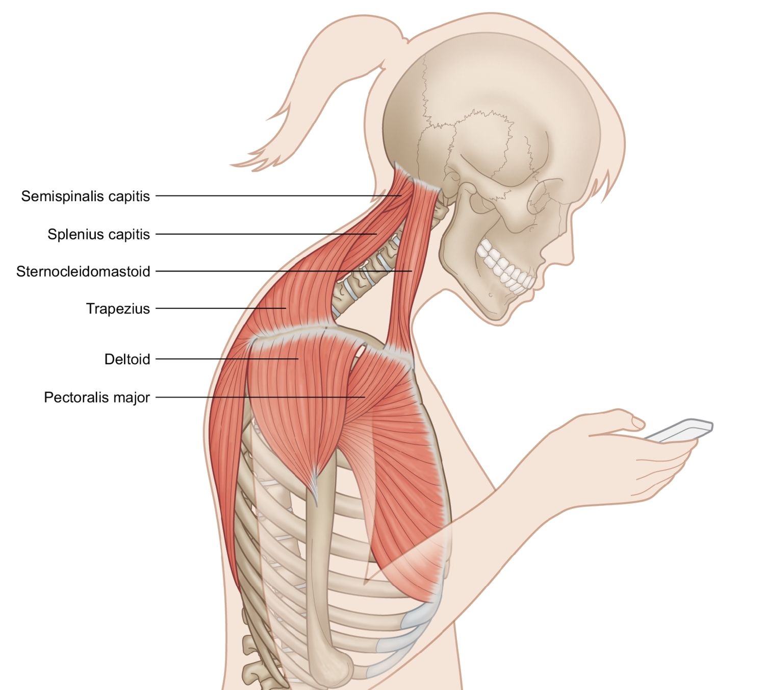 bad_position